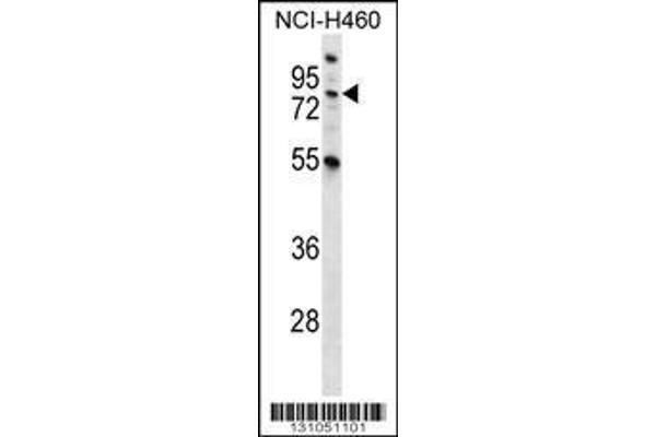 anti-Macrophage Stimulating 1 (Hepatocyte Growth Factor-Like) (MST1) (AA 454-483), (C-Term) antibody