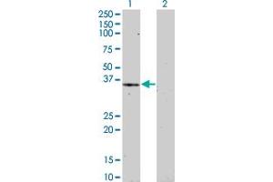 anti-Ha-Ry/enhancer-of-Split Related with YRPW Motif 1 (HEY1) (AA 121-220) antibody