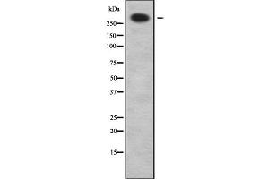 Image no. 1 for anti-ATP-Binding Cassette, Sub-Family A (ABC1), Member 12 (ABCA12) antibody (ABIN6259675)
