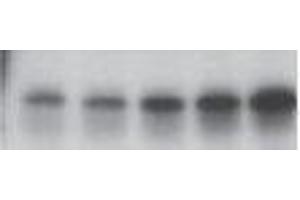 Western Blotting (WB) image for anti-Tumor Protein P53 (TP53) (pSer46) antibody (ABIN3201005)