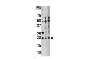 Image no. 1 for anti-Ribosomal Protein L23A (RPL23A) (AA 111-140), (C-Term) antibody (ABIN388651)
