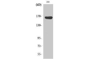 Image no. 1 for anti-ATP-Binding Cassette, Sub-Family C (CFTR/MRP), Member 12 (ABCC12) (Internal Region) antibody (ABIN3183115)