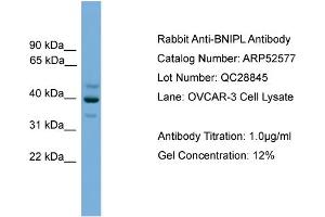 Image no. 2 for anti-BCL2/adenovirus E1B 19kD Interacting Protein Like (BNIPL) (Middle Region) antibody (ABIN2784994)