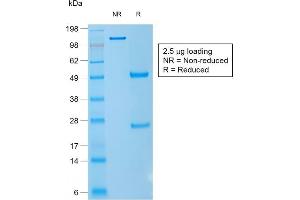 Image no. 1 for anti-CD1a (CD1a) antibody (ABIN6941002)
