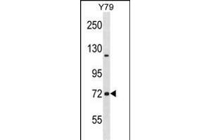 NCDN Antibody (N-term) (ABIN1538979 and ABIN2848609) western blot analysis in Y79 cell line lysates (35 μg/lane).