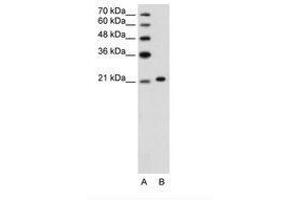 Image no. 3 for anti-Ankyrin 1, Erythrocytic (ANK1) (C-Term) antibody (ABIN203434)