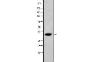anti-Abhydrolase Domain Containing 10 (ABHD10) (Internal Region) antibody