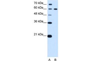 Image no. 1 for anti-Deltex Homolog 2 (DTX2) antibody (ABIN2462679)