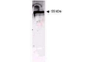 Western blot using ROCKLAND Immunochemical's Mouse Anti-Keratin antibody.