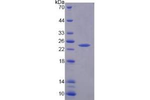 Image no. 1 for Receptor (TNFRSF)-Interacting serine-threonine Kinase 1 (RIPK1) (AA 1-179) protein (His tag) (ABIN6237359)