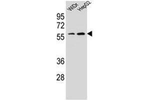 Image no. 2 for anti-Homeobox A10 (HOXA10) (AA 234-262), (Middle Region) antibody (ABIN952772)