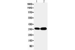Image no. 2 for anti-LIM and SH3 Protein 1 (LASP1) (AA 152-168), (C-Term) antibody (ABIN5518689)