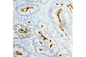 Image no. 3 for anti-Carcinoembryonic Antigen-Related Cell Adhesion Molecule 1 (Biliary Glycoprotein) (CEACAM1) antibody (ABIN3043635)