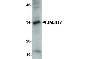 Image no. 1 for anti-Jumonji Domain Containing 7 (JMJD7) (C-Term) antibody (ABIN6656985)