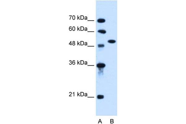 anti-Activin Receptor Type I (ACRV1) (N-Term) antibody
