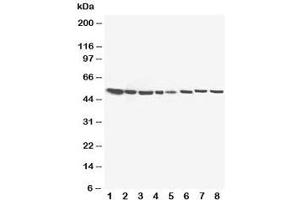 Image no. 3 for anti-Hydroxysteroid (17-Beta) Dehydrogenase 4 (HSD17B4) (C-Term) antibody (ABIN3031274)