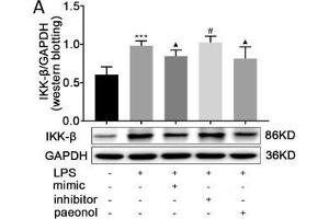 Image no. 5 for anti-Inhibitor of kappa Light Polypeptide Gene Enhancer in B-Cells, Kinase beta (IKBKB) antibody (ABIN3022876)