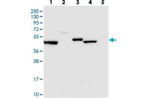 Western blot analysis of Lane 1: RT-4, Lane 2: U-251 MG, Lane 3: Human Plasma, Lane 4: Liver, Lane 5: Tonsil with UAP1L1 polyclonal antibody  at 1:250-1:500 dilution.