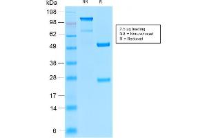 Image no. 1 for anti-CD52 (CD52) antibody (ABIN6939056)