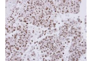 Image no. 1 for anti-Fanconi Anemia Group A Protein (FANCA) (N-Term) antibody (ABIN2856901)