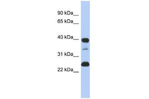 Image no. 2 for anti-Thymopoietin (TMPO) (N-Term) antibody (ABIN2782012)
