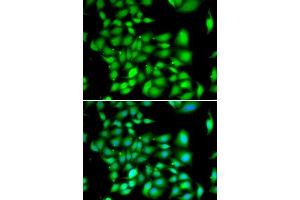 Image no. 1 for anti-three Prime Repair Exonuclease 1 (TREX1) antibody (ABIN6149486)