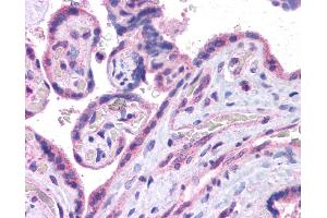 Image no. 3 for anti-V-Maf Musculoaponeurotic Fibrosarcoma Oncogene Homolog (Avian) (MAF) (N-Term) antibody (ABIN2780675)