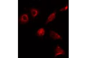 Image no. 1 for anti-ALX Homeobox 3 (ALX3) (Internal Region) antibody (ABIN6258604)
