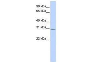 Image no. 1 for anti-Yip1 Interacting Factor Homolog B (YIF1B) (AA 144-193) antibody (ABIN6740915)