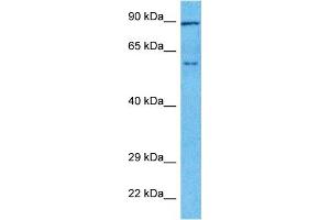 Image no. 1 for anti-Thymus High Mobility Group Box Protein (TOX) (Middle Region) antibody (ABIN5514552)