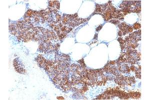Image no. 3 for anti-Parathyroid Hormone (PTH) (AA 32-115) antibody (ABIN6940428)