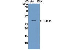 Image no. 1 for anti-Macrophage Stimulating 1 (Hepatocyte Growth Factor-Like) (MST1) (AA 469-704) antibody (ABIN1859890)