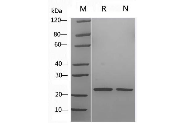 Sonic Hedgehog (SHH) (AA 25-198), (Cys25IleIle-Mutant) (Active) protein