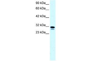 Image no. 6 for anti-Single-Stranded DNA Binding Protein 2 (SSBP2) (N-Term) antibody (ABIN2777444)