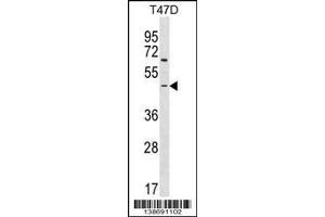 Western Blotting (WB) image for anti-rho Guanine Nucleotide Exchange Factor (GEF) 35 (ARHGEF35) (Center) antibody (ABIN2159240)