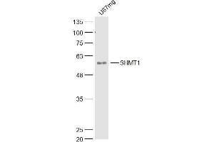Image no. 1 for anti-serine Hydroxymethyltransferase 1 (Soluble) (SHMT1) (AA 301-400) antibody (ABIN5675633)