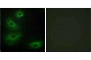 Image no. 2 for anti-Serotonin Receptor 1B (HTR1B) (AA 201-250) antibody (ABIN1534239)