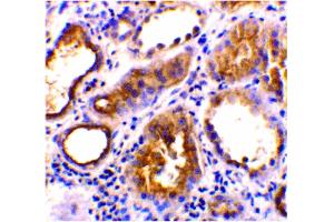 Image no. 3 for anti-Angiotensin I Converting Enzyme 2 (ACE2) (Internal Region) antibody (ABIN6655906)