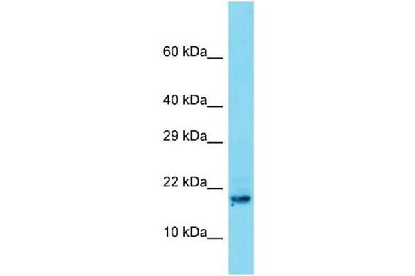 anti-Testis Development Related Protein (TDRP) (N-Term) antibody
