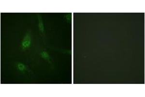Immunofluorescence analysis of HeLa cells, using NFAT4 (Phospho-Ser165) Antibody.