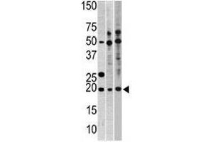 Image no. 1 for anti-Ribosomal Protein L23A (RPL23A) (C-Term) antibody (ABIN357267)