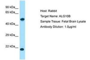 Image no. 1 for anti-Asparagine-Linked Glycosylation 10, alpha-1,2-Glucosyltransferase Homolog B (ALG10B) (AA 104-153) antibody (ABIN6750148)