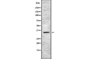 Image no. 1 for anti-SRY (Sex Determining Region Y)-Box 12 (SOX12) (Internal Region) antibody (ABIN6265232)