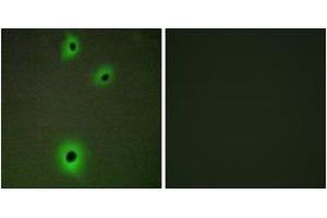 Image no. 1 for anti-Cell Adhesion Molecule 4 (CADM4) (AA 339-388) antibody (ABIN1534303)