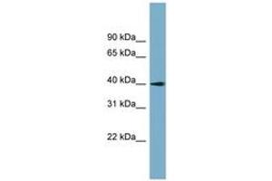 anti-Solute Carrier Family 25 (Mitochondrial Carrier: Glutamate), Member 22 (SLC25A22) (AA 71-120) antibody