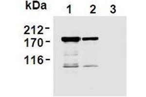 Image no. 2 for anti-Topoisomerase (DNA) II alpha 170kDa (TOP2A) antibody (ABIN1109281)