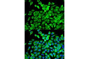 Image no. 4 for anti-Eukaryotic Translation Initiation Factor 4A2 (EIF4A2) antibody (ABIN1876482)