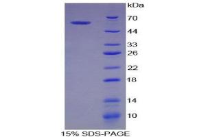 Image no. 1 for Baculoviral IAP Repeat Containing 2 (BIRC2) (AA 344-593) protein (His tag,GST tag) (ABIN1981158)