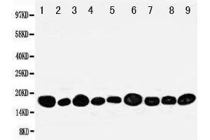 Image no. 2 for anti-Nucleoside diphosphate kinase B (NME2) (AA 137-152), (C-Term) antibody (ABIN3044198)