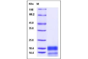 Image no. 1 for G Protein gamma 13 (GNg13) (AA 1-64), (Mature) protein (His tag) (ABIN2005515)